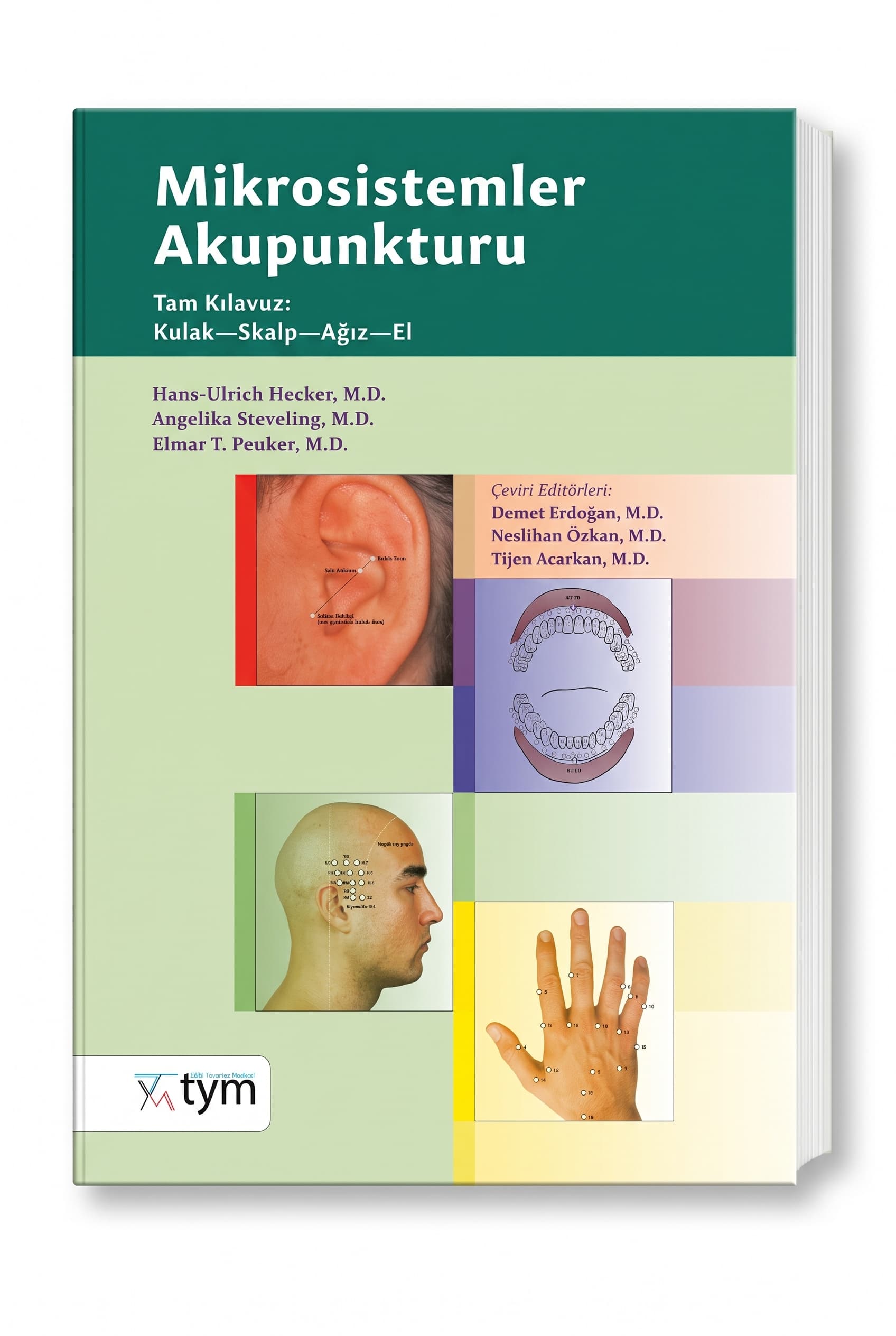 Mikrosistemler Akupunkturu